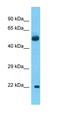 Keratin Associated Protein 27-1 antibody, orb325229, Biorbyt, Western Blot image 