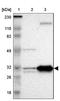 Enoyl-CoA Hydratase 1 antibody, NBP1-83216, Novus Biologicals, Western Blot image 