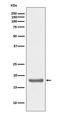 Interleukin 10 antibody, M00021, Boster Biological Technology, Western Blot image 