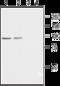 Calcium Voltage-Gated Channel Auxiliary Subunit Beta 2 antibody, GTX54771, GeneTex, Western Blot image 