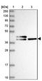 Chitinase Domain Containing 1 antibody, NBP1-81901, Novus Biologicals, Western Blot image 