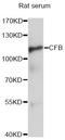 Complement Factor B antibody, LS-C748303, Lifespan Biosciences, Western Blot image 