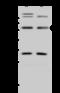 Zinc Finger Protein 100 antibody, 203224-T40, Sino Biological, Western Blot image 