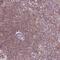 ADA33 antibody, PA5-64312, Invitrogen Antibodies, Immunohistochemistry paraffin image 