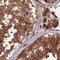 McKusick-Kaufman Syndrome antibody, PA5-60653, Invitrogen Antibodies, Immunohistochemistry paraffin image 