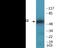 P21 (RAC1) Activated Kinase 2 antibody, EKC2170, Boster Biological Technology, Western Blot image 