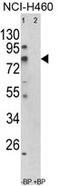 Acyl-CoA Synthetase Short Chain Family Member 3 antibody, AP17866PU-N, Origene, Western Blot image 