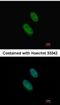 Enhancer Of Zeste 1 Polycomb Repressive Complex 2 Subunit antibody, NBP1-32111, Novus Biologicals, Immunocytochemistry image 