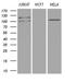 Diacylglycerol Kinase Zeta antibody, LS-C799060, Lifespan Biosciences, Western Blot image 