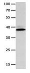 Complement Factor H Related 1 antibody, PA5-49704, Invitrogen Antibodies, Western Blot image 