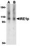 Ire1-alpha antibody, orb74677, Biorbyt, Western Blot image 