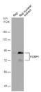 Forkhead Box P1 antibody, GTX129252, GeneTex, Western Blot image 