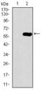 Dynactin Subunit 4 antibody, GTX60723, GeneTex, Western Blot image 