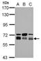 TBC1 Domain Family Member 22A antibody, GTX122604, GeneTex, Western Blot image 