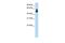 Histone Deacetylase 9 antibody, PA5-42247, Invitrogen Antibodies, Western Blot image 