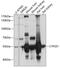 Cytochrome P450 Family 2 Subfamily E Member 1 antibody, A2160, ABclonal Technology, Western Blot image 