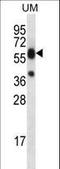 Lipase Family Member M antibody, LS-C165797, Lifespan Biosciences, Western Blot image 