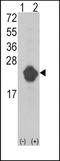 Interleukin 1 Receptor Antagonist antibody, TA324842, Origene, Western Blot image 