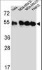 Tubulin Beta 4B Class IVb antibody, LS-C160332, Lifespan Biosciences, Western Blot image 