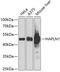 Hyaluronan And Proteoglycan Link Protein 1 antibody, GTX32643, GeneTex, Western Blot image 