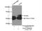 Tousled Like Kinase 1 antibody, 13564-1-AP, Proteintech Group, Immunoprecipitation image 