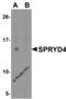 SPRY Domain Containing 4 antibody, 6407, ProSci, Western Blot image 