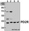 Prostaglandin D2 receptor antibody, A06190-2, Boster Biological Technology, Western Blot image 