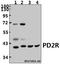 Prostaglandin D2 Receptor antibody, A06190-2, Boster Biological Technology, Western Blot image 