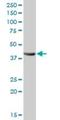 Alcohol Dehydrogenase 4 (Class II), Pi Polypeptide antibody, H00000127-B01P, Novus Biologicals, Western Blot image 