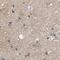 DDB1 And CUL4 Associated Factor 7 antibody, PA5-54642, Invitrogen Antibodies, Immunohistochemistry frozen image 