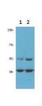 Cyclin Dependent Kinase 9 antibody, NB120-10874, Novus Biologicals, Western Blot image 