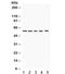 Potassium Voltage-Gated Channel Subfamily A Member 3 antibody, R32012, NSJ Bioreagents, Western Blot image 