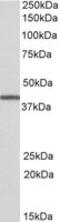 Tribbles Pseudokinase 1 antibody, MBS423331, MyBioSource, Western Blot image 
