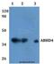 Abhydrolase Domain Containing 4 antibody, LS-C412088, Lifespan Biosciences, Western Blot image 