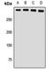 Ubiquitin Specific Peptidase 24 antibody, orb411807, Biorbyt, Western Blot image 