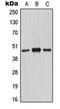 Mannan Binding Lectin Serine Peptidase 1 antibody, orb214464, Biorbyt, Western Blot image 