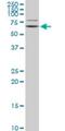 G Protein-Coupled Receptor Kinase 6 antibody, H00002870-M06, Novus Biologicals, Western Blot image 