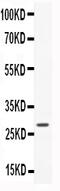 Ciliary Neurotrophic Factor antibody, PB9012, Boster Biological Technology, Western Blot image 