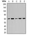 Karyopherin Subunit Alpha 1 antibody, orb378151, Biorbyt, Western Blot image 
