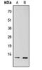 TATA-Box Binding Protein Associated Factor 13 antibody, orb304620, Biorbyt, Western Blot image 