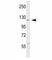 ABL Proto-Oncogene 1, Non-Receptor Tyrosine Kinase antibody, F50694-0.4ML, NSJ Bioreagents, Immunohistochemistry frozen image 