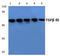 Transforming Growth Factor Beta Receptor 1 antibody, AP01457PU-N, Origene, Western Blot image 