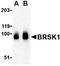 BR Serine/Threonine Kinase 1 antibody, NBP1-76778, Novus Biologicals, Western Blot image 