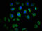 Toll Like Receptor 6 antibody, CSB-PA023605LA01HU, Cusabio, Immunofluorescence image 