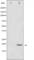 Stathmin 1 antibody, abx011940, Abbexa, Western Blot image 