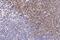 Enhancer Of Zeste 2 Polycomb Repressive Complex 2 Subunit antibody, GTX01878, GeneTex, Immunohistochemistry paraffin image 
