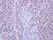Zinc Finger MYND-Type Containing 11 antibody, PA5-27899, Invitrogen Antibodies, Immunohistochemistry frozen image 