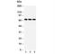 Interleukin-1 receptor-associated kinase 3 antibody, R31330, NSJ Bioreagents, Western Blot image 