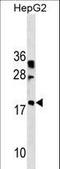 Ladybird Homeobox 2 antibody, LS-C160036, Lifespan Biosciences, Western Blot image 