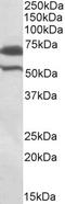 Baculoviral IAP Repeat Containing 3 antibody, EB10369, Everest Biotech, Western Blot image 